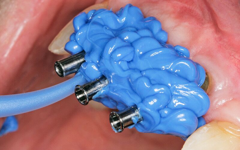 Honigum Pro Heavy 2x50 ml - otisna masa – DMG - Slika 2