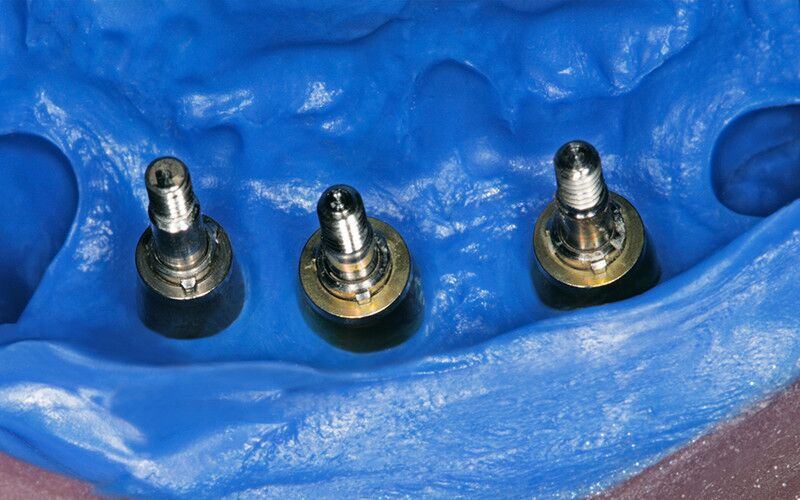 Honigum Pro Heavy 2x50 ml - otisna masa – DMG - Slika 3