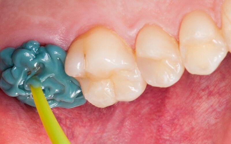 Honigum Pro Mono - MixStar 380 ml - otisna masa - DMG - Slika 2