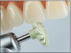 CompGloss, gumice za poliranje kompozita sivozelene - Edenta - Slika 2