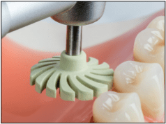 CompGloss, gumice za poliranje kompozita sivozelene - Edenta - Slika 3