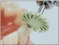 CompGloss, gumice za poliranje kompozita sivozelene - Edenta - Slika 4