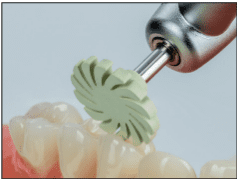 CompGloss, gumice za poliranje kompozita sivozelene - Edenta - Slika 5